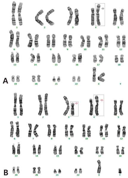 kjped-55-107-g004.jpg