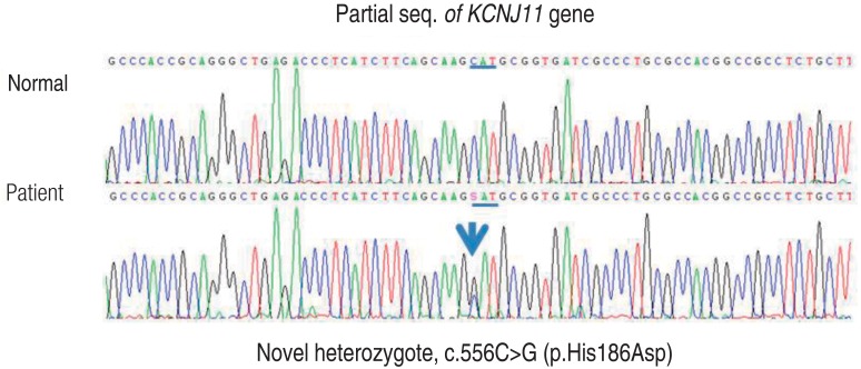 kjped-58-309-g001.jpg