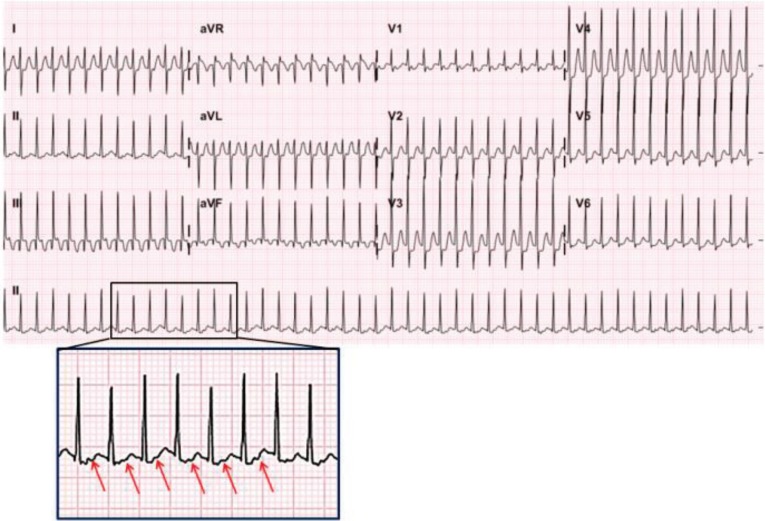 kjped-60-344-g003.jpg